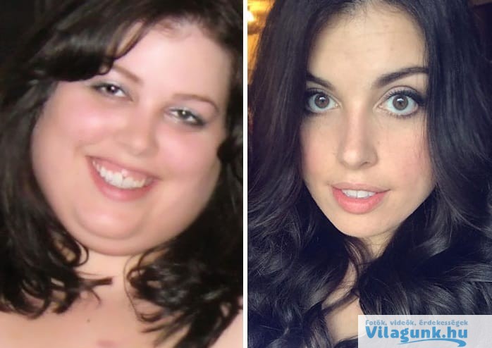 2 45 12 hihetetlen példa arra, hogyan változik meg az emberek arca, egy nagy fogyás után!