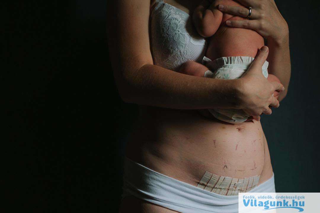 06 2 27 csodálatraméltó anya, aki megmutatta, hogyan néz ki valójában a teste egy szülés után