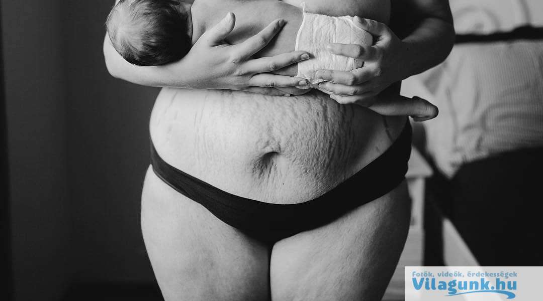10 4 27 csodálatraméltó anya, aki megmutatta, hogyan néz ki valójában a teste egy szülés után