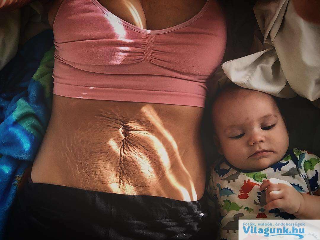 15 4 27 csodálatraméltó anya, aki megmutatta, hogyan néz ki valójában a teste egy szülés után