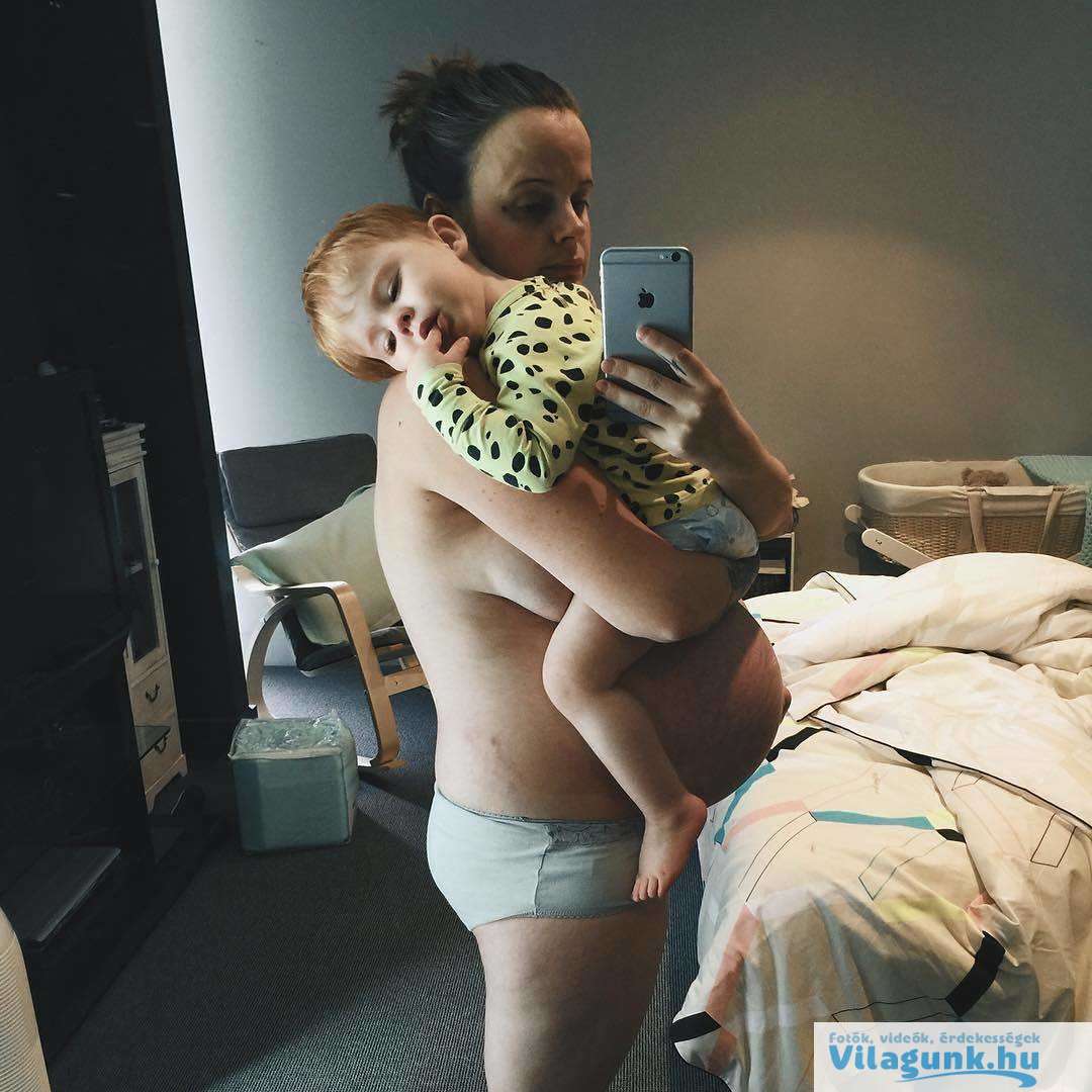 29 27 csodálatraméltó anya, aki megmutatta, hogyan néz ki valójában a teste egy szülés után