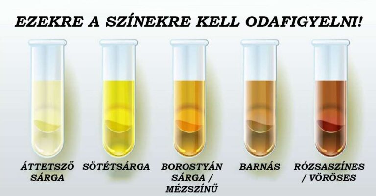 A vizeleted színe rengeteget elárulhat az egészségi állapotodról, jobb ha te is tisztában vagy a jelentésével