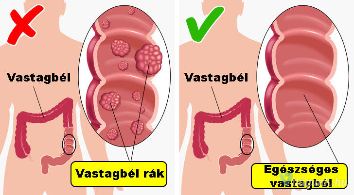 04 18 Ez a 12 dolog történik a testeddel, ha rendszeresen eszel uborkát.