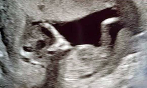 wert6z789 Megrémült a várandós tini amikor meglátta az ultrahang képet, amit az orvosa mutatott neki