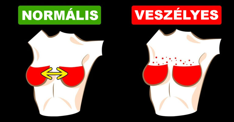 6 veszélyes emlőprobléma, ami nagy mértékben veszélyeztetheti az egészségedet