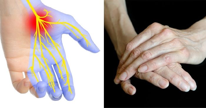 amit a kezed elarul az egeszsegedrol 5 7 dolog az egészségedről, amit a kezed mutat meg neked