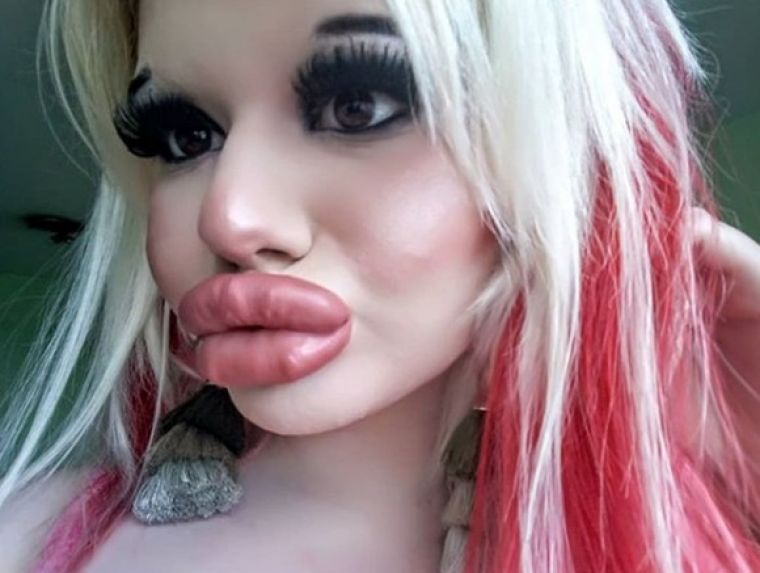 andrea emilova ivanova 3 Ez a fiatal nő a világ legnagyobb ajkaira vágyik - Így nézett ki a plasztikai műtétek előtt