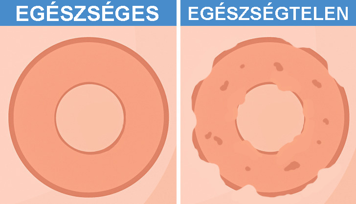 07 6 Íme a test 7 kritikus része, amire sokkal jobban kellene vigyázni