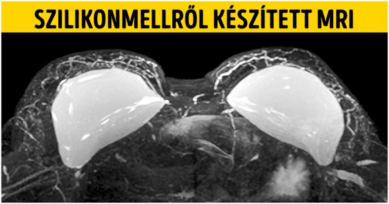 16 különleges röntgenkép, amely eddig rejtve volt előttünk, de a radiológusok most lerántották a leplet