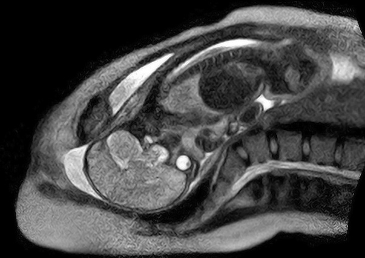 10949015 mri scan 1571236803 728 567e109322 1571393797 16 különleges röntgenkép, amely eddig rejtve volt előttünk, de a radiológusok most lerántották a leplet