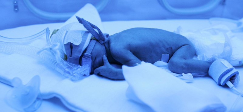 image Egészségesen hagyhatta el a kórházat a 245 grammal született baba