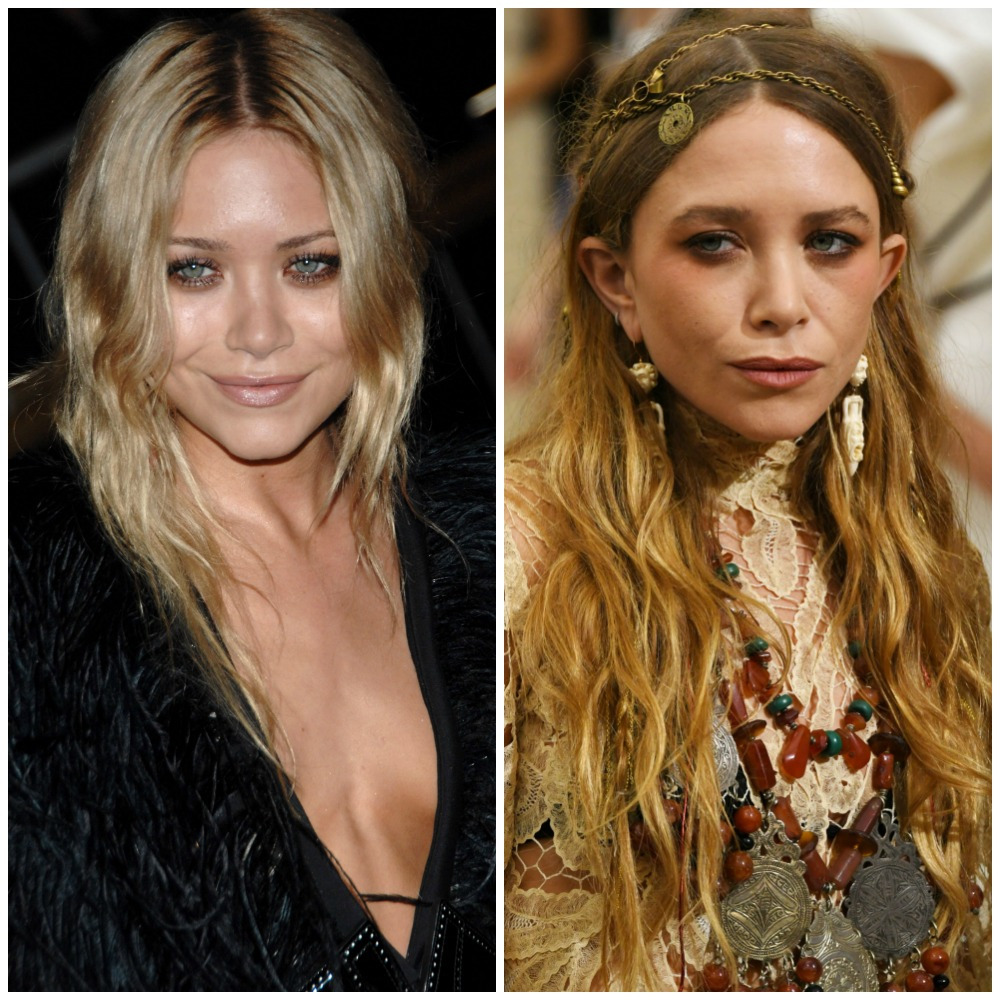 mary kate olsen before after Íme néhány híres nő, aki plasztikai műtéttel változtatott megjelenésén