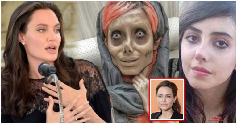 Ez a nő Angelina Jolie-ra szeretett volna hasonlítani – Végül 10 év börtönt kapott