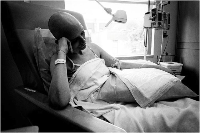 7 4 Milyen egy rákos beteg élete? Ez a döbbenetes fotósorozat bemutatja!