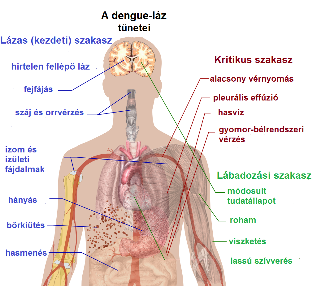 486532 Azonnal fordulj orvoshoz, ha ilyen szúnyogcsípést látsz magadon! - Veszélyben lehet az életed!