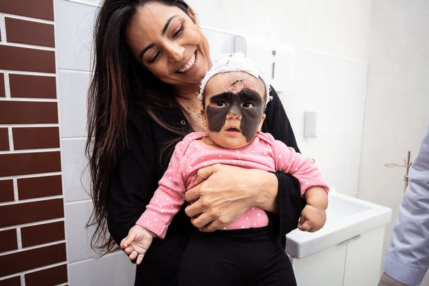 kep 2021 12 10 131719 "Most már egy igazi hercegnő vagyok" - Így néz ki most a 2 éves kislány akinek az arcáról eltávolítottak egy hatalmas anyajegyet