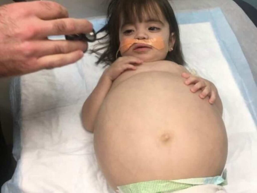 Father Donates One Kidney To His Little Daughter01