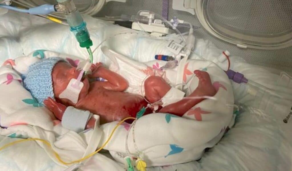 preemie baby in hospital SWNS Az anyai ösztönök mentették meg a gyermek életét, semmi jele nem volt, hogy probléma lenne.