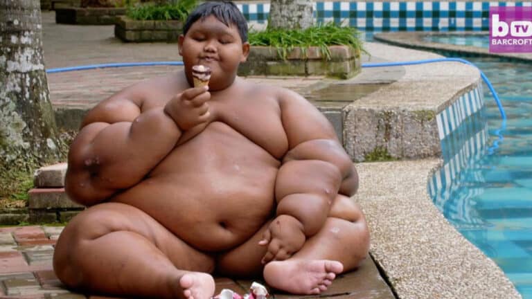 ELKÉPESZTŐ ÁTALAKULÁS! A világ legkövérebb gyereke 192 kiló volt 10 évesen. Nézd meg most…