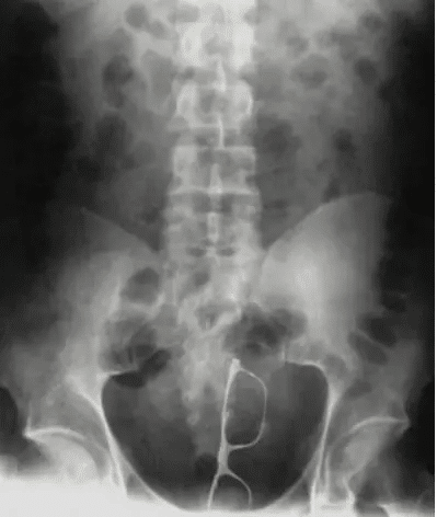 kep 2022 10 25 100120479 14 ritka röntgenfelvétel, amin még az orvosok is kiakadtak. "Fáj, ha rájuk nézek..."