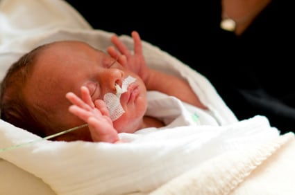 baby with ng tube Döbbenet: Így változik meg a baba arca, ha az anya italozik terhesség alatt