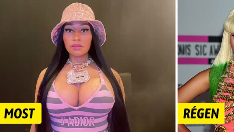 Nicki Minaj nagyon megbánta a plasztikai műtéteket, miután megnézte a régi fotóit…