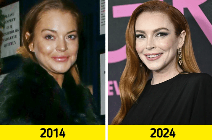 kep 2024 09 07 174854638 "Feloldódott a botox" Lindsay Lohan, a babaarcú lány teljesen megváltozott.